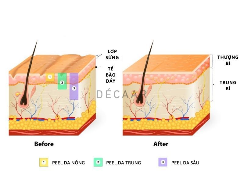 trước khi peel da nên làm gì